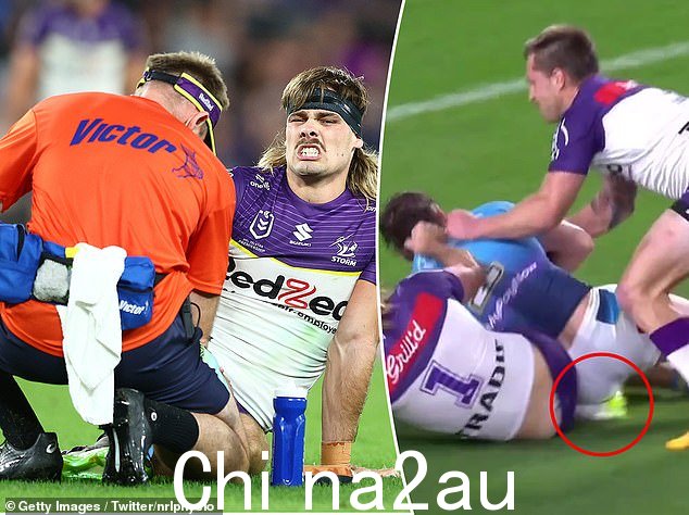 Ryan Papenhuyzen 在风暴队以 22-20 获胜的比赛中小腿骨折