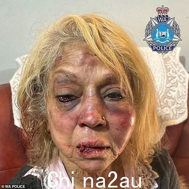 另一名被释放的被拘留者 Majid Jamshidi Doukoshkan,43 岁,是因涉嫌残酷殴打 73 岁的 Ninette Simmons(如图)而被指控的三人之一