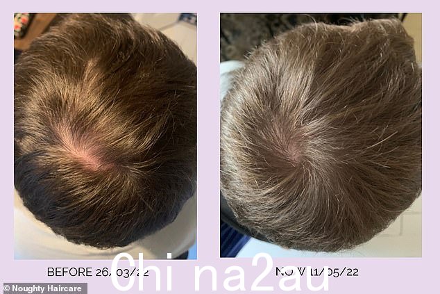 '迄今为止我在头发上用过的最好的东西':Noughty Growth 系列的用户已经看到了厚度和头发生长的明显差异