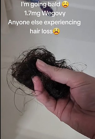 如上图所示,这位女士在 TikTok 上发布了一条令人担忧的信息,她手里拿着一簇在淋浴时掉落的头发