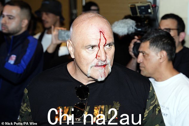 Fury 的父亲 John 在战斗周的一次争吵中用头撞了乌西克阵营的一名成员
