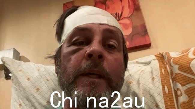 南澳大利亚男子 Keith Davis谈到了本周早些时候遭受严重湍流袭击的新加坡航空公司飞机内部的恐怖情况。图片:日出