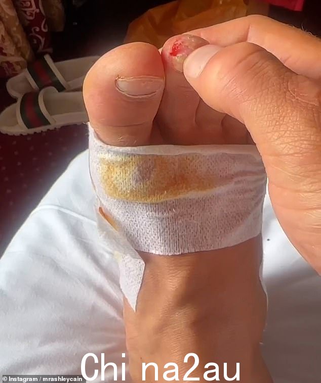Cain 说,他的脚、应力性骨折和包括眼泪在内的其他损伤现在在骑行过程中得到了“治愈的机会”