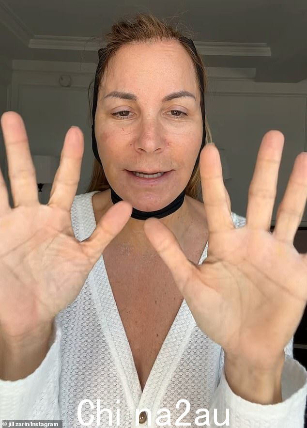 这位真人秀明星告诉她的粉丝,她的手术中最糟糕的部分是对她的腿部进行抽脂术,以便将脂肪转移到她的手上。她说这是唯一受到严重伤害的部分