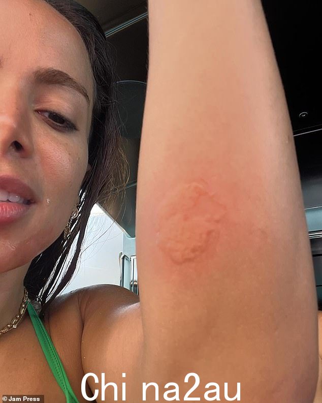 Anitta 在周末欧洲之旅中休息时正在探索岛屿