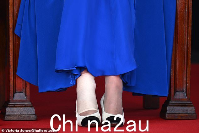 女王今天早上出席根西岛议会审议国特别会议,右脚踝上缠着压缩绷带