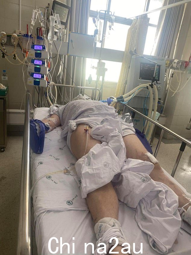 澳大利亚男子 James Lothian(如图)在泰国一家医院中为生命而绝望,因为他迫切需要捐赠稀有血型