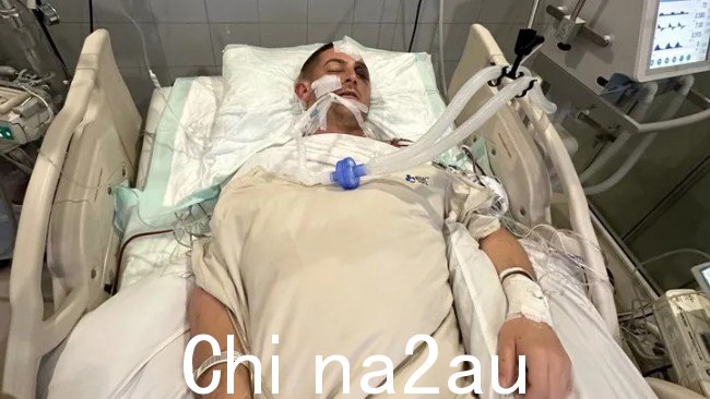 一位来自珀斯的技工目前正在依靠生命维持系统在巴厘岛,他的摩托车撞上了一根杆子,导致他头骨骨折,肺部流血,脑部严重受损。图片:GoFundMe