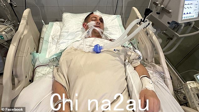 这位年轻的技工自周日以来一直在医院,他的家人说他们不知道他受伤的全部程度