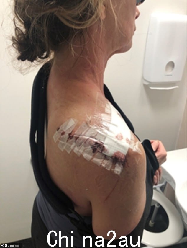 Jacqui Kent 被马袭击后,她的生活发生了翻天覆地的变化