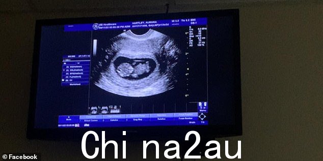 哈特利说她对这个错误感到非常震惊,并指出她一直想成为一名妈妈