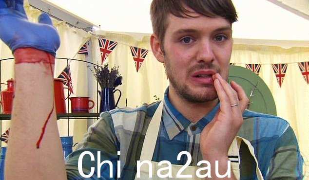 在第三季决赛中,参赛者 John Whaite 在电动搅拌机上割伤手指后受重伤