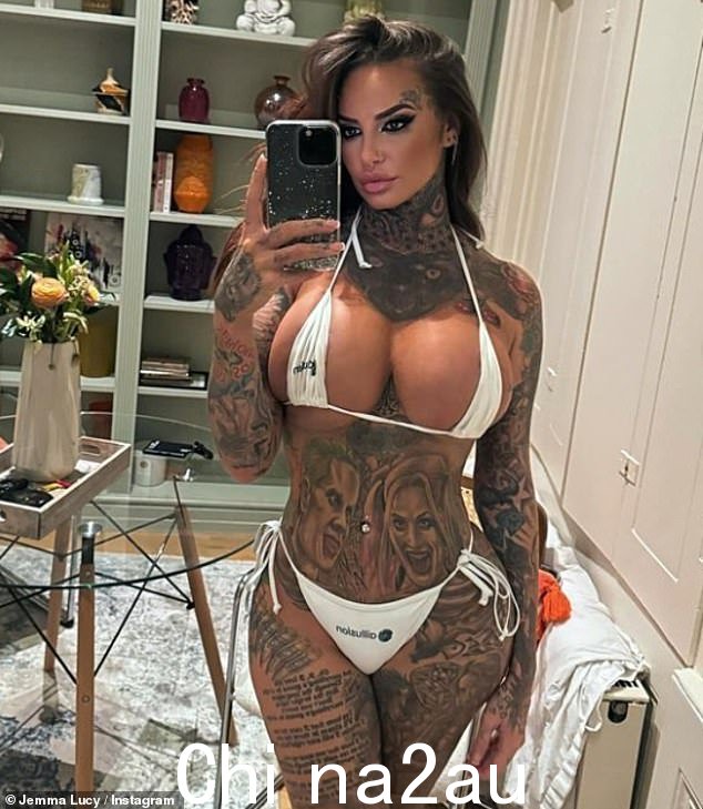 Jemma Lucy 透露了她是多么容易成为牛仔从业者注射填充剂的“合格者”,以及她自己被搞砸的经历