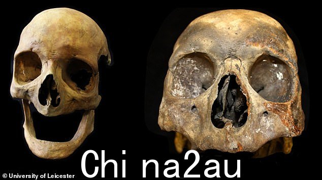 有时骨骼的牙齿无法存活或与身体其他部分分离并丢失,无法简单判断该人是否吸烟
