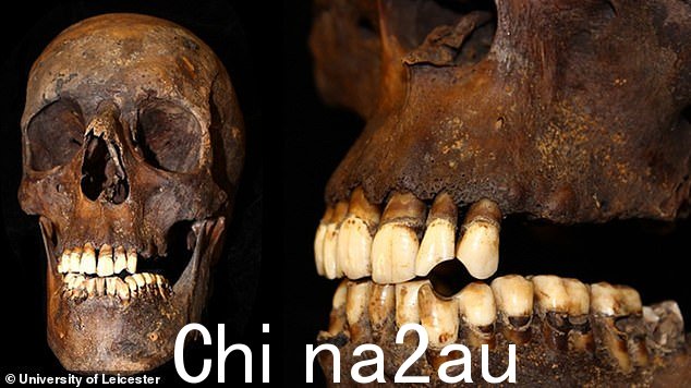 科学家可以通过牙齿上的污渍或痕迹判断死者是否吸烟。例如,被称为“烟斗凹口”的凹痕可能是由烟斗形成的,而‘舌染色’是牙齿表面面向舌头的部分出现黑色或棕色痕迹