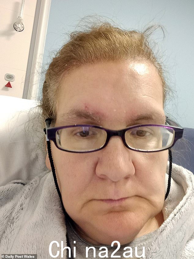 来自登比郡里尔的 54 岁离婚妈妈格温妮丝·罗伯茨 (Gwyneth Roberts) 因胸痛被送往 Bodelwyddan 的 Ysbyty Glan Clwyd 医院,32 小时后在医院候诊室找到一张床位