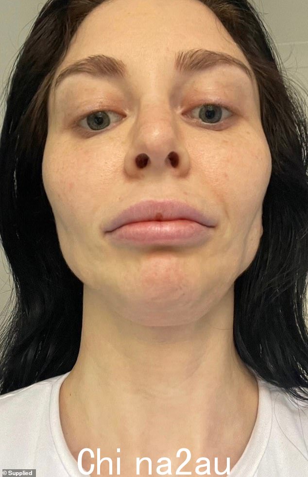 和萨顿女士说,每次剧烈神经疼痛使人衰弱时,她都会看到自己的身体失去更多功能