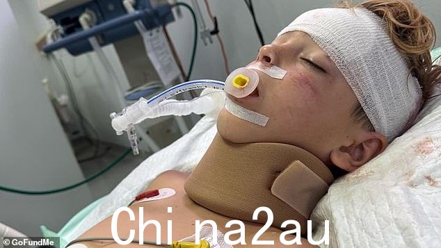Joshua Schuetz,8 岁,在乘坐的四轮摩托车翻转后受了外伤