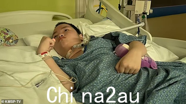 米拉被闪电严重烧伤,她母亲认为她被击中时看起来已经死了