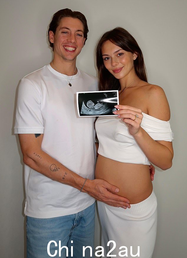 The pregnancy came as a shock to the pair, particularly to model Alice, 24, who has polycystic ovaries, so they decided to find out the baby's sex early to plan for the future